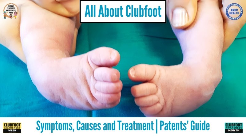 All About Clubfoot. Parents' Guide. Global Clubfoot Awareness Parv by Dr. Krupesh Thacker.